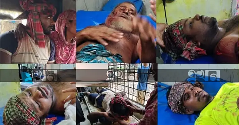 হামলায় ৮ জন আহত